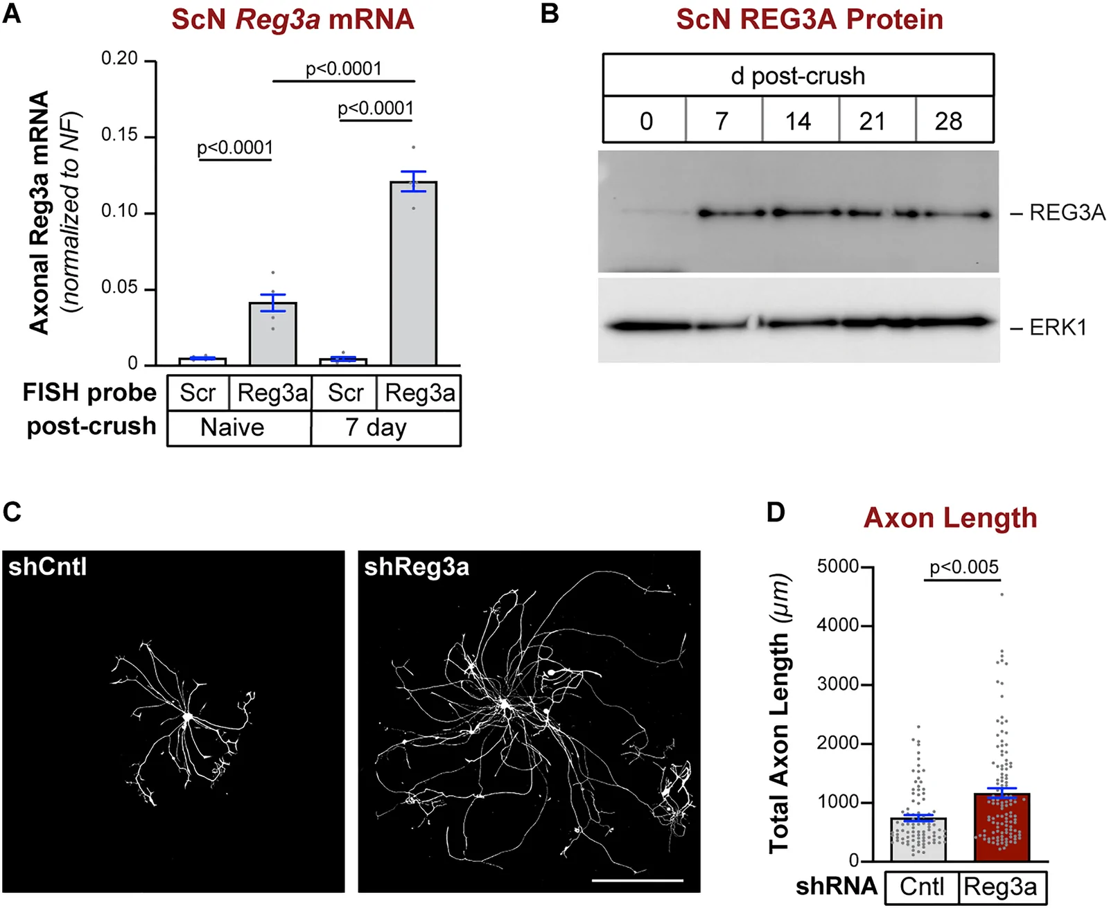 Fig. 1 of the paper: Axon injury increases axonal REG3A mRNA and protein.